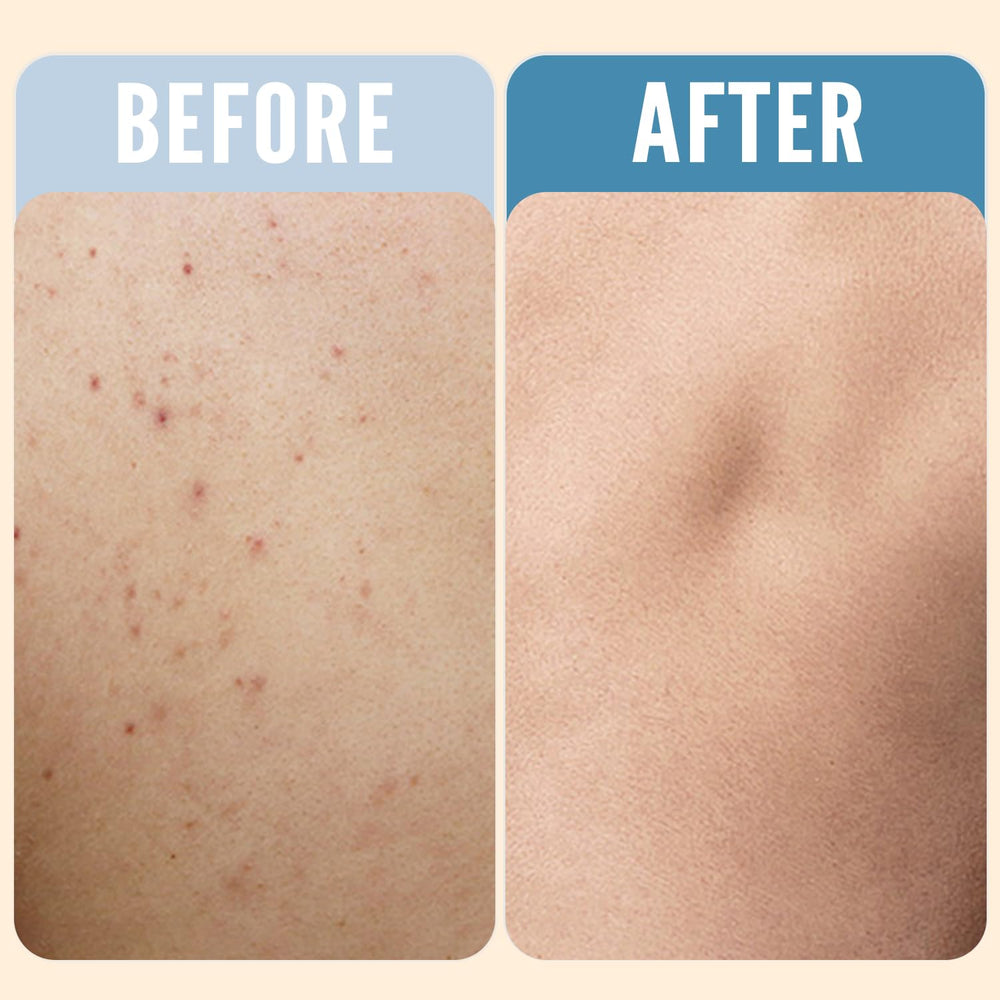 Rinse & Robust close-up texture showing exfoliating salt and charcoal