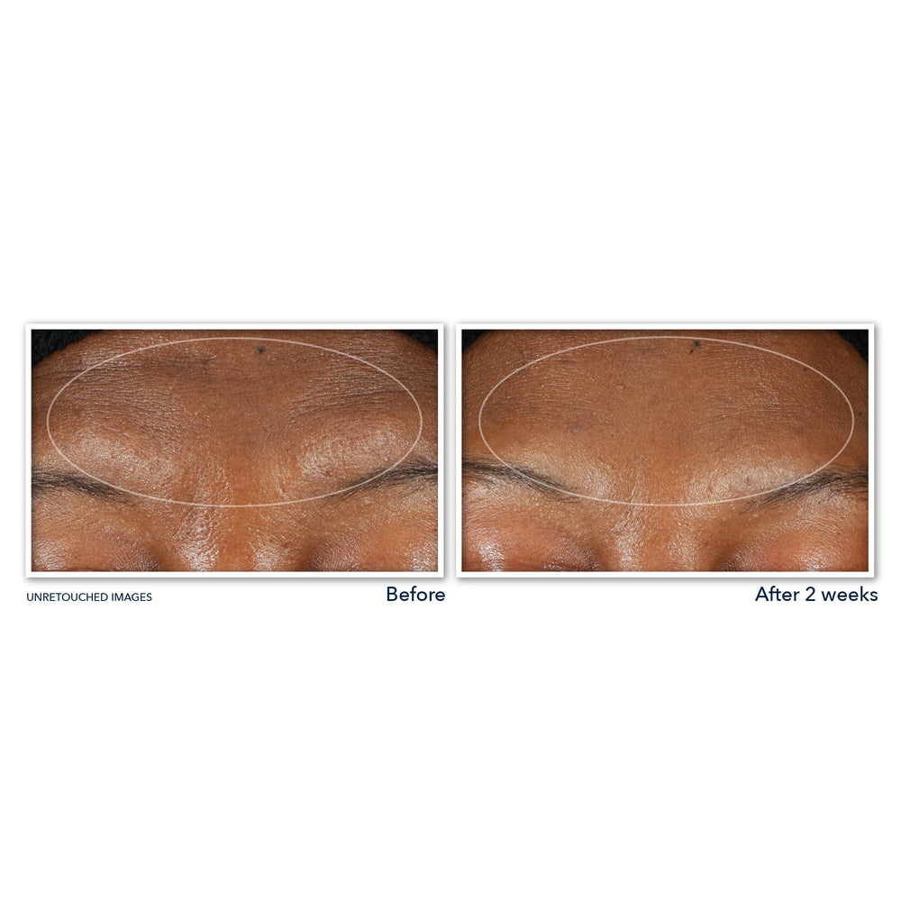 RoC lather removing mascara and foundation, illustrating effective makeup removal benefit