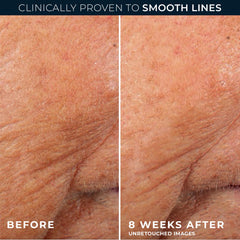 RoC ingredient callout showing retinol and ceramides for skin support