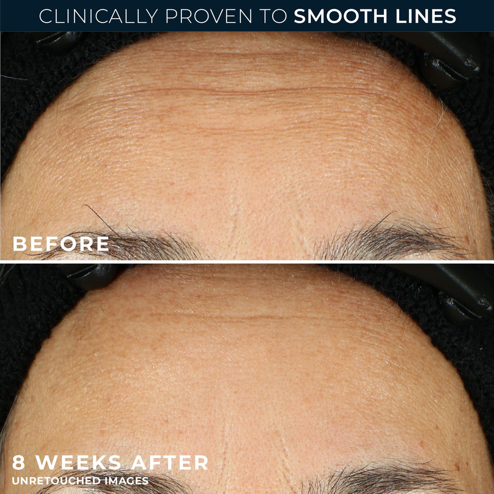 RoC applying night serum to face and neck demonstrating even coverage