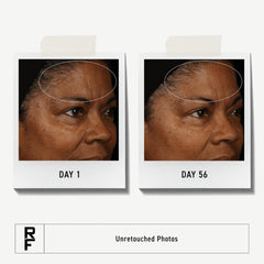 RODAN + FIELDS clay cream swirl demonstrating gentle exfoliation