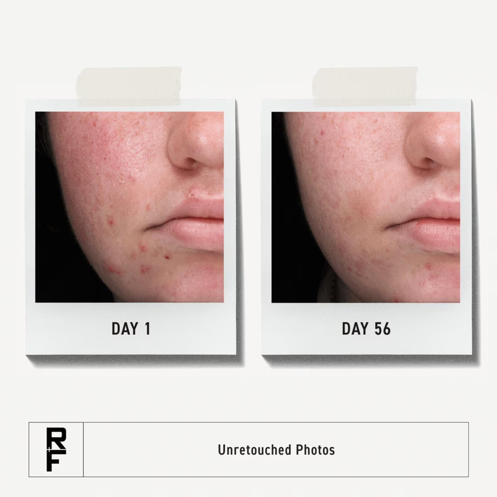 Rodan + Fields wash pump close-up highlighting easy dispensing and control