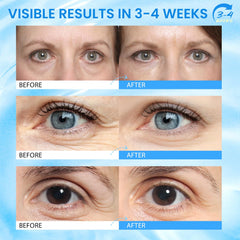 RONKIE eye stick in hand demonstrating easy twist-up application benefit