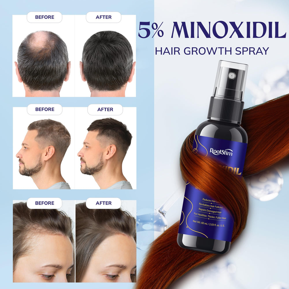 RootStim applied to scalp at thinning crown to support thicker looking hair