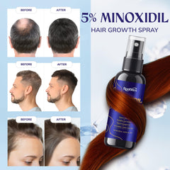 RootStim applied to scalp at thinning crown to support thicker looking hair