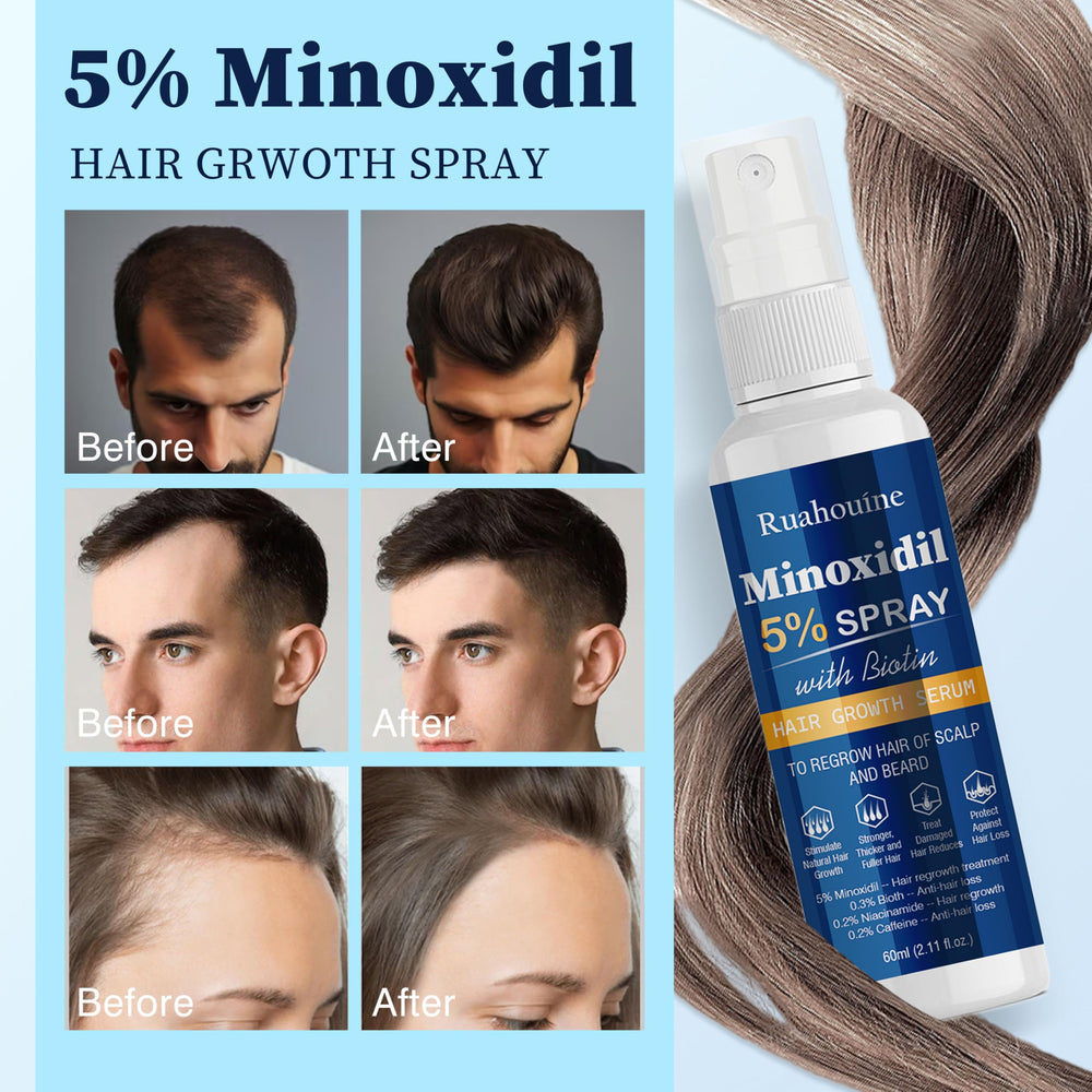 Applying Ruahouine spray to thinning scalp to target hair follicles