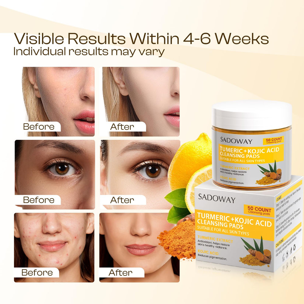SADOWAY turmeric root and kojic acid graphic showing natural brightening support