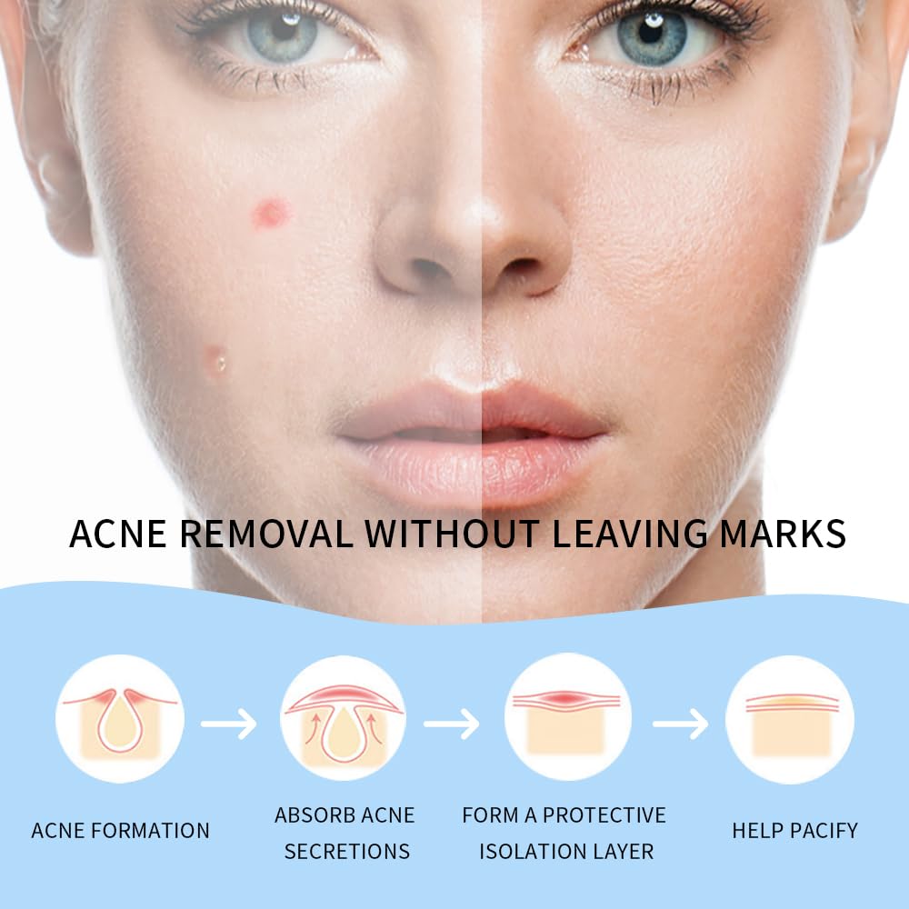 Safirst peeling off patch detail showing easy removal and no-residue benefit