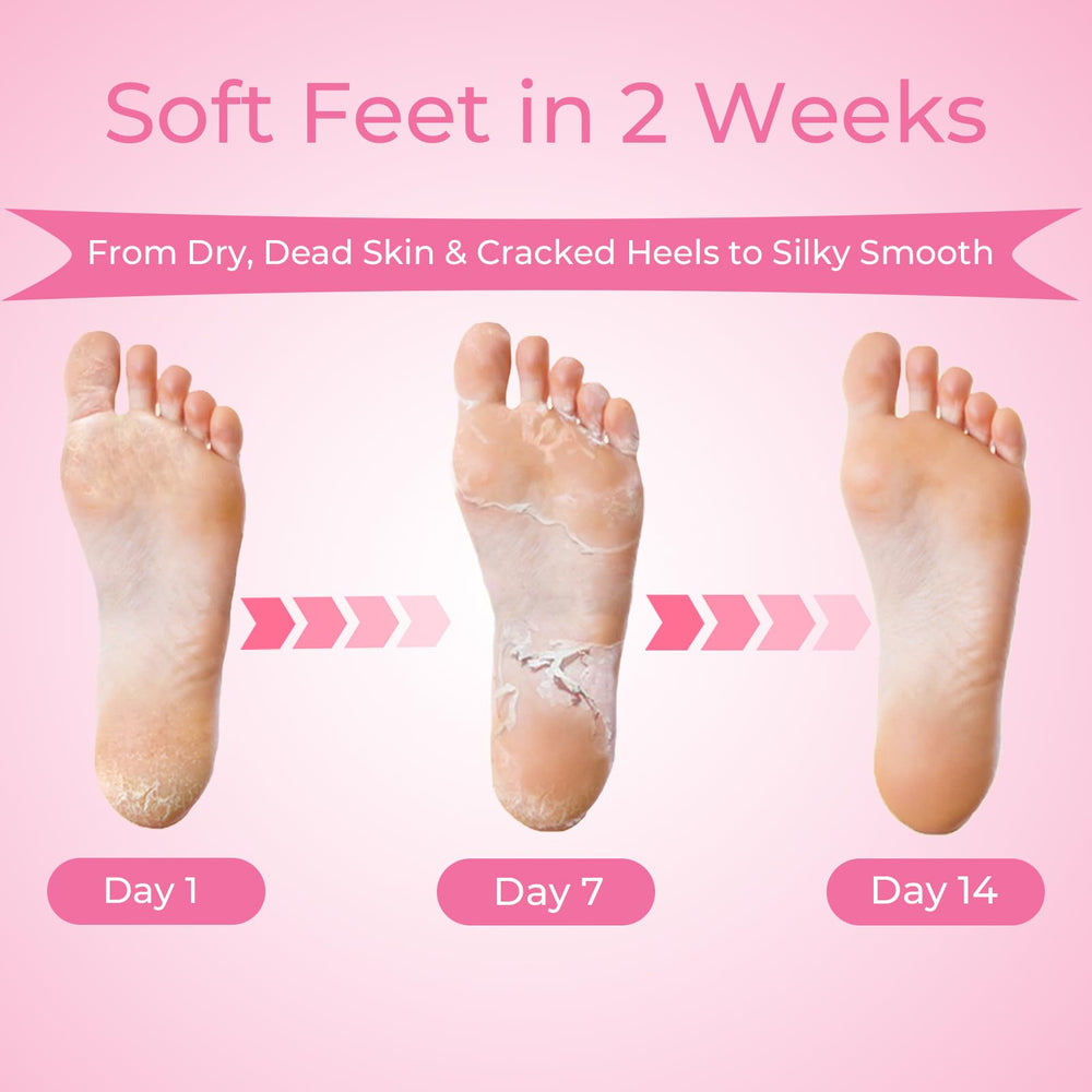 SAISZE booties worn during treatment demonstrating easy application benefit