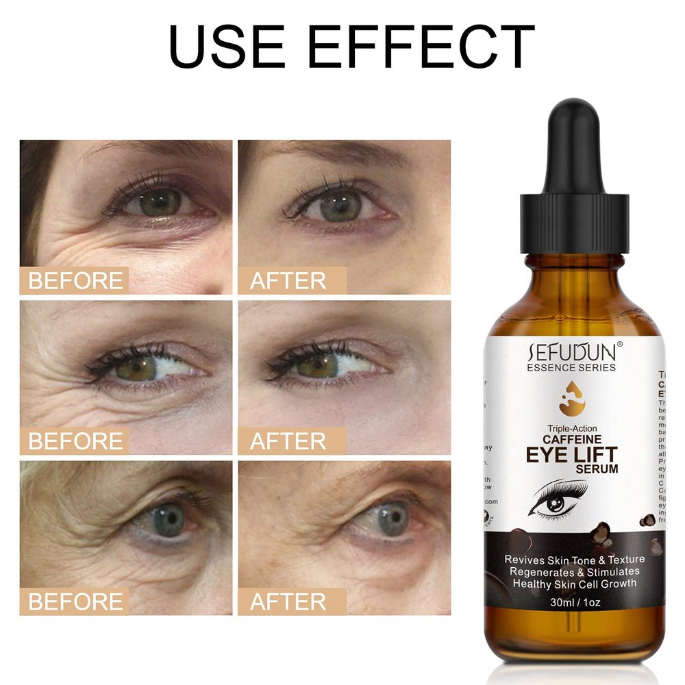 sefudun applying serum under eye for calmer hydrated skin