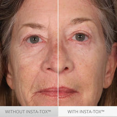 Serious Skincare application on neck and jawline illustrating immediate tightening benefit