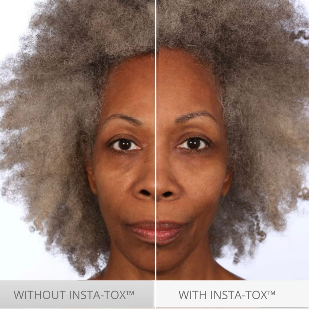 Serious Skincare under-eye spot application highlighting reduced puffiness appearance