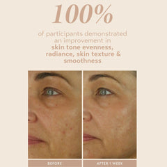 SHANI DARDEN applying serum to face and neck demonstrating gentle nightly use