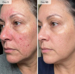 Shining Face application on neck demo illustrating improved serum absorption