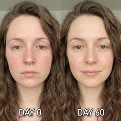 Shining Face application on neck demonstrating targeted treatment