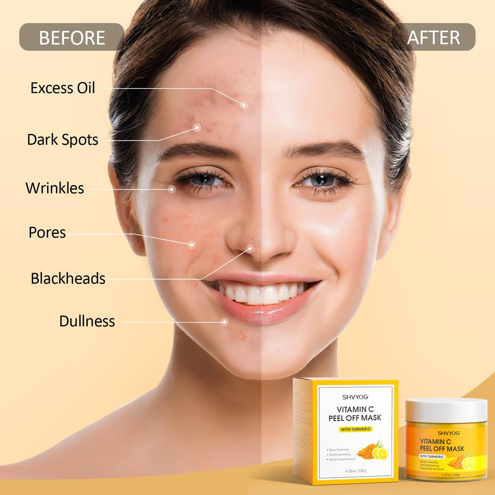 SHVYOG removed mask sheet on hand illustrating lifted impurities