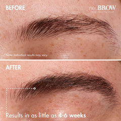 Skin Research Laboratories neuBROW applied along brow illustrating even coverage and definition