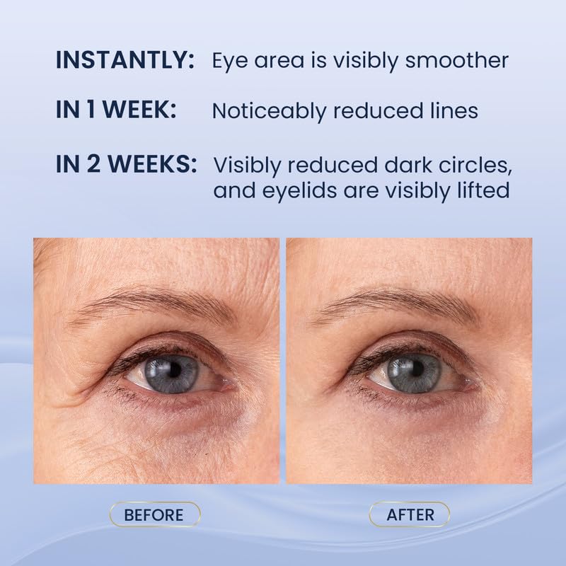 SKIN ULTIMA lower eye cream texture close-up showing rich hydration