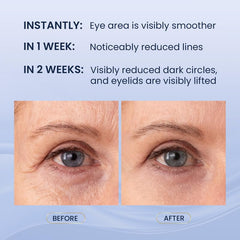 SKIN ULTIMA lower eye cream texture close-up showing rich hydration