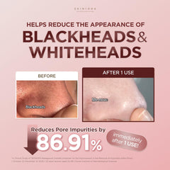 SKIN1004 applying clay stick to cheek demonstrating targeted pore care benefit
