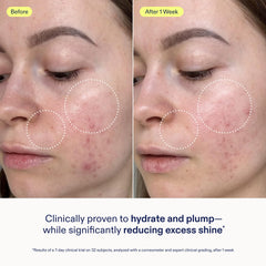Skinfix pump dispensing gel cream for controlled, hygienic application