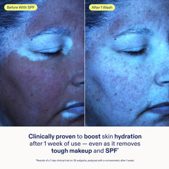 Skinfix gel cleanser texture close-up showing clear gel consistency and gentle feel