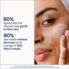 Skinfix ingredient panel close-up listing acids and soothing botanicals