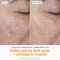 Skinfix in-use on face demonstrating even application and non-greasy finish
