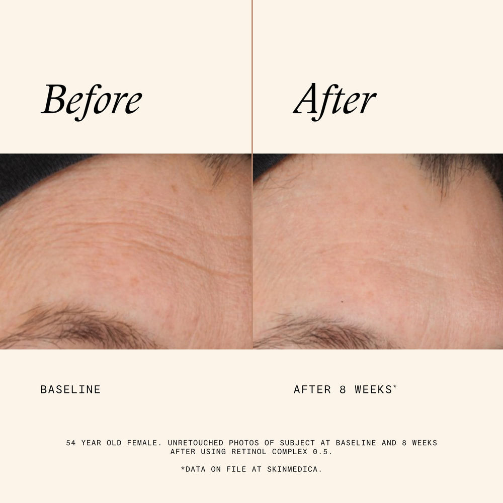 SkinMedica ingredient label close-up showing active ingredients for targeted benefit