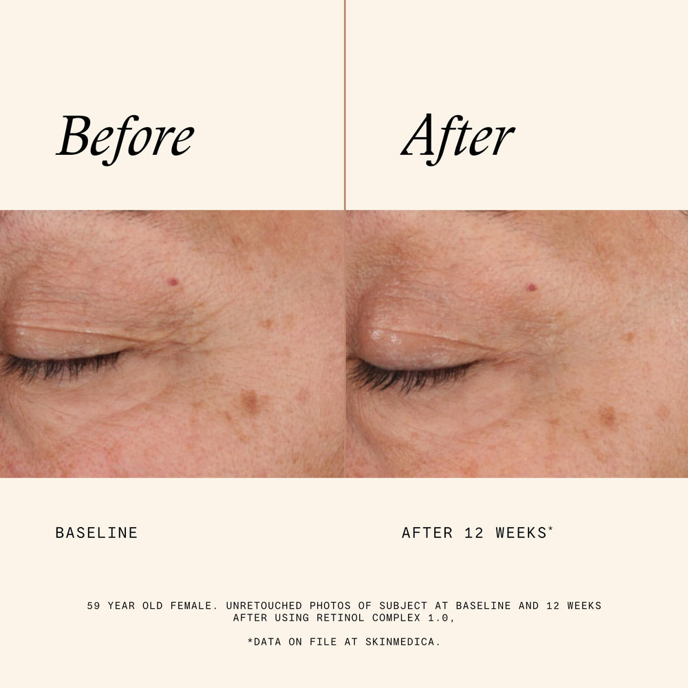 SkinMedica bottle label detail highlighting retinol strength and PhytoShield