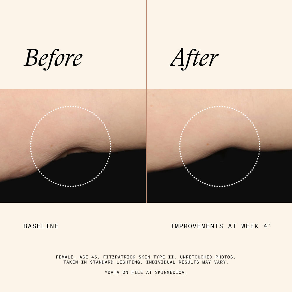 SkinMedica texture close-up showing smooth lotion consistency for quick absorption