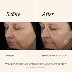 SkinMedica pump dispensing TNS Advanced plus for precise dosing and fresh mix