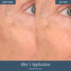 SKINN before and after shot showing improved texture and reduced dullness