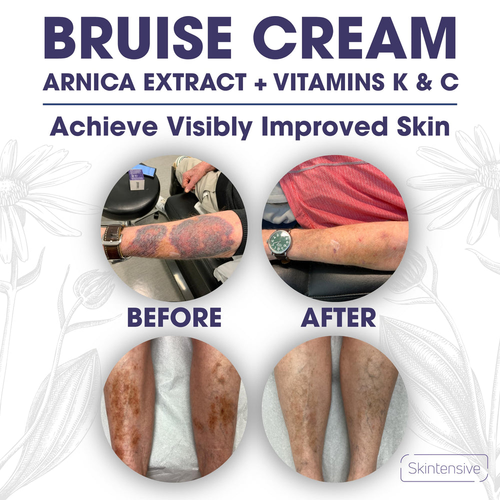 SKINTENSIVE used by a senior showing gentle care for delicate skin