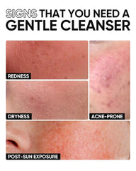 SKINTIFIC cleanser staged on bathroom shelf during morning routine, supports daily use