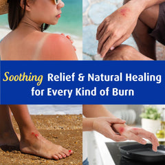 Solarcaine application on arm illustrating cooling relief for sun-exposed skin