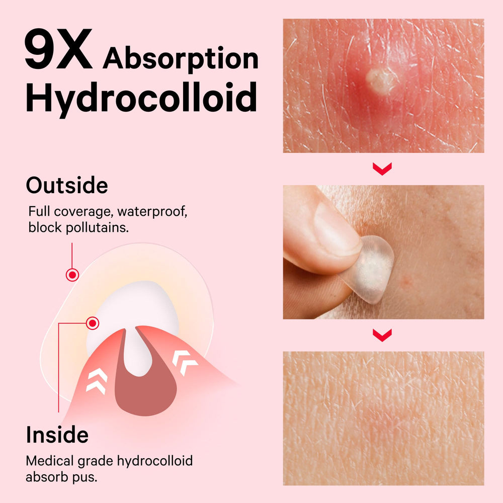 Sosky patch applied on cheek demonstrating secure adhesion