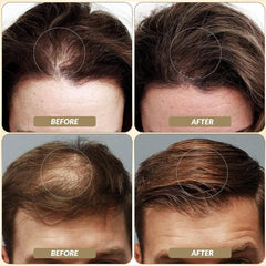 SOVONCARE step-by-step application on thinning area for quick concealment benefit