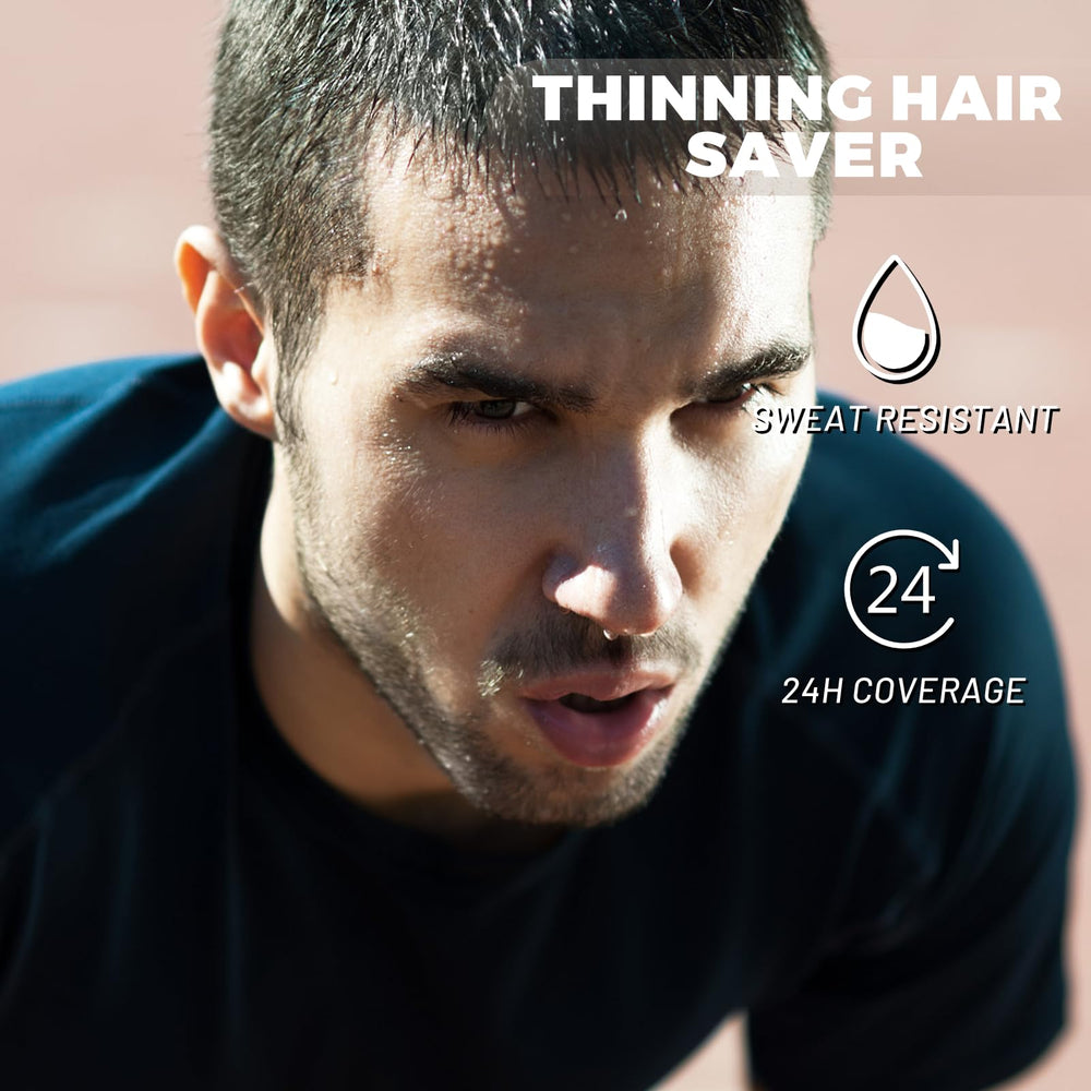 SOVONCARE before and after scalp comparison showing fuller hair benefit