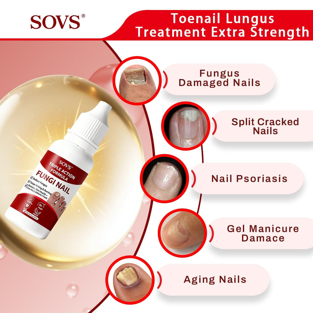 SOVS in-use application on toe illustrating convenient daily use benefit