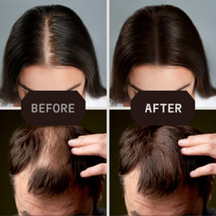 Top-view before and after using Striking Viking fibers demonstrating fuller hair benefit