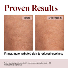 STRIPES applying body butter on arm demonstrating smooth spread and hydration
