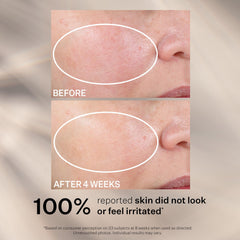 StriVectin cream on fingertip demonstrating spreadability and nourishing feel