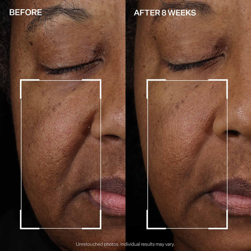 StriVectin label close-up emphasizing peptide blend and skin-friendly formulation