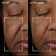 StriVectin label close-up emphasizing peptide blend and skin-friendly formulation