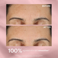 StriVectin next to ruler showing 1 oz size for travel-friendly benefit