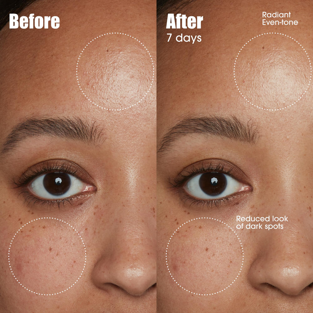 Sunday Riley serum dropper texture on skin demonstrating fast absorption benefit