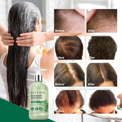 Svvimer close-up of bottle label highlighting biotin and tea tree benefits
