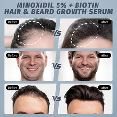 Sylvaseren with rosemary and biotin ingredients highlighting nourishment