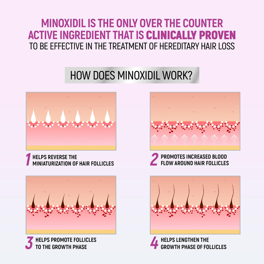 TARO application on scalp demonstration targeting thinning areas